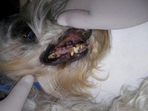 profilaxis dental