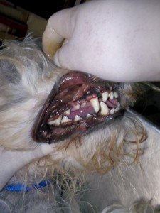 profilaxis dental
